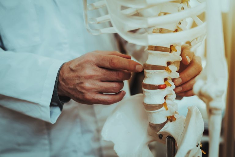 Why Choose Spinal Fusion Surgery?