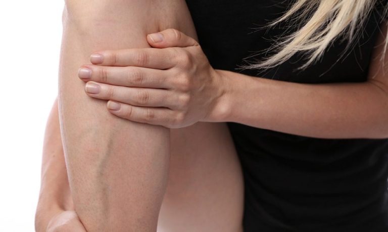 Varicose Veins During Pregnancy: Signs to Look out For