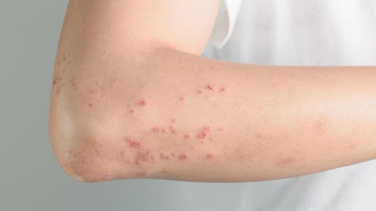 7 Common Causes of Skin Allergies