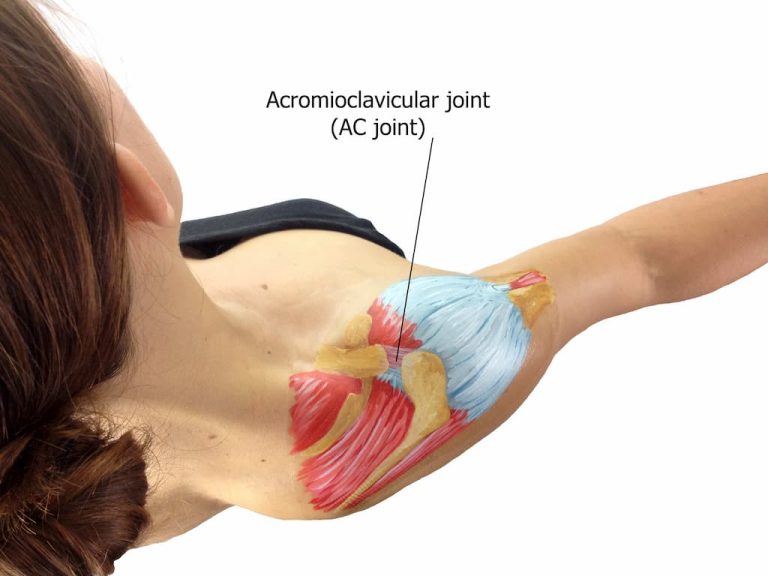 What is the Recovery Time for Acromioclavicular Joint Reconstruction?