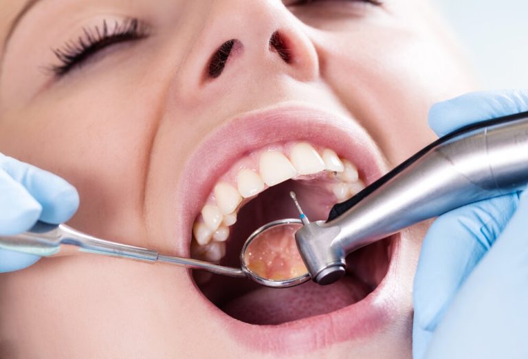 The Most Common Procedures In General And Cosmetic Dentistry