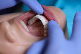 Why General Dentistry Is Key To Detecting Oral Cancer Early