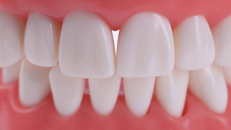 Tracking Dental Wear Patterns To Improve Bite Alignment And Comfort
